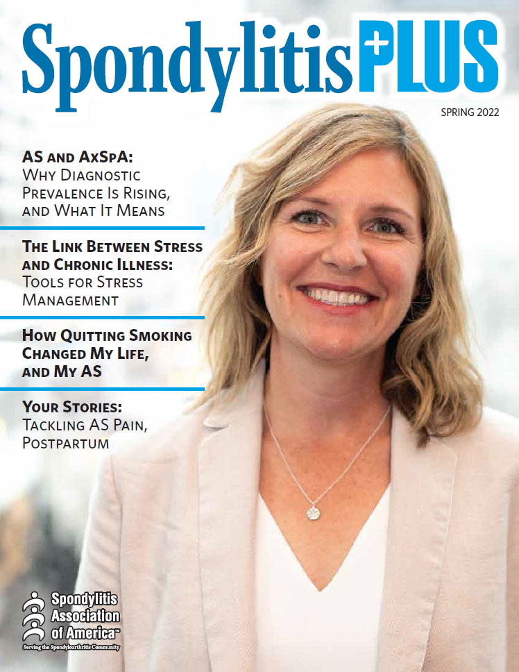 Spondy-Plus-2022-Spring